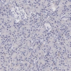 Immunohistochemical staining of human pancreas shows no positivity in exocrine glandular cells as expected.