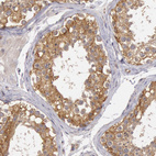 Anti-NMT2 Antibody