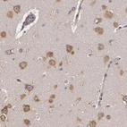 Anti-NMT2 Antibody