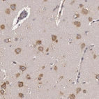Immunohistochemical staining of human Cerebral cortex shows moderate cytoplasmic positivity in neuronal cells.