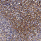 Immunohistochemical staining of human Tonsil shows moderate membranous positivity in non-germinal center cells.