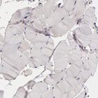 Immunohistochemical staining of human Skeletal muscle shows very weak cytoplasmic positivity in myocytes.