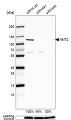 Anti-NMT2 Antibody