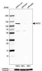 Western blot analysis in U2OS cells transfected with control siRNA, target specific siRNA probe #1 and #2, using Anti-NMT2 antibody. Remaining relative intensity is presented. Loading control: Anti-GAPDH.