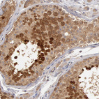 Anti-DNAJA1 Antibody