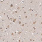 Immunohistochemical staining of human cerebral cortex shows moderate cytoplasmic positivity in neurons.