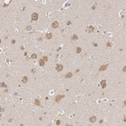 Anti-DNAJA1 Antibody