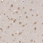 Immunohistochemical staining of human cerebral cortex shows moderate cytoplasmic positivity in neurons.