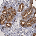 Immunohistochemical staining of human Fallopian tube shows strong cytoplasmic positivity in glandular cells.