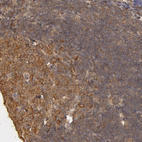 Immunohistochemical staining of human lymph node shows strong cytoplasmic and membranous positivity in germinal center cells.