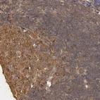 Immunohistochemical staining of human lymph node shows strong cytoplasmic and membranous positivity in germinal center cells.