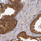 Immunohistochemical staining of human prostate shows strong cytoplasmic and membranous positivity in glandular cells.