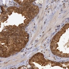 Immunohistochemical staining of human prostate shows strong cytoplasmic and membranous positivity in glandular cells.