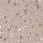Immunohistochemical staining of human cerebral cortex shows moderate cytoplasmic and membranous positivity in neurons.