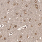 Immunohistochemical staining of human cerebral cortex shows moderate cytoplasmic and membranous positivity in neurons.