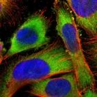 Immunofluorescent staining of human cell line U-251 MG shows localization to cytosol.