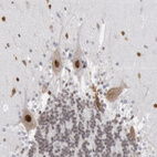 Anti-SUB1 Antibody