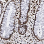 Immunohistochemical staining of human rectum shows strong nuclear positivity in glandular cells.