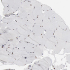 Immunohistochemical staining of human skeletal muscle shows moderate nuclear positivity in myocytes.