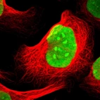 Immunofluorescent staining of human cell line U-2 OS shows localization to nucleus & nucleoli.
