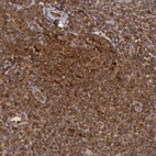 Anti-TAP2 Antibody