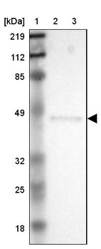 Lane 1: Marker [kDa] 219, 112, 85, 49, 32, 25, 18_br/_Lane 2: Human cell line RT-4_br/_Lane 3: Human cell line U-251MG sp
