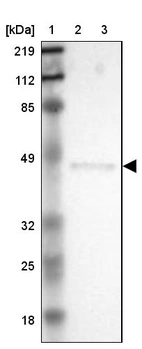 Lane 1: Marker [kDa] 219, 112, 85, 49, 32, 25, 18_br/_Lane 2: Human cell line RT-4_br/_Lane 3: Human cell line U-251MG sp