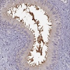 Anti-EDDM3B Antibody