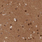 Anti-BRAF Antibody