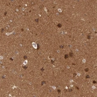 Immunohistochemical staining of human cerebral cortex shows strong cytoplasmic positivity in neuronal cells.