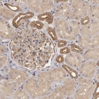 Immunohistochemical staining of human kidney shows moderate cytoplasmic positivity in distal tubules.