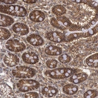Immunohistochemical staining of human gastrointestinal shows strong membranous positivity in glandular cells.