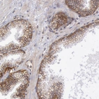 Immunohistochemical staining of human prostate shows strong membranous positivity in glandular cells.
