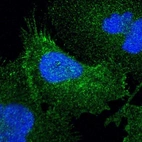 Immunofluorescent staining of human cell line U-251 MG shows localization to plasma membrane.