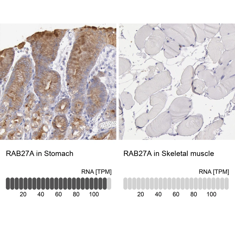 Rabbit Polyclonal Anti-RAB27A Antibody - Buy for research - Highly ...