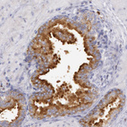 Anti-RAB27A Antibody
