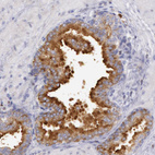 Immunohistochemical staining of human prostate shows strong cytoplasmic positivity in glandular cells.