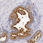 Immunohistochemical staining of human prostate shows strong cytoplasmic positivity in glandular cells.