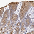 Immunohistochemical staining of human stomach shows strong cytoplasmic positivity in glandular cells with additional stron membranous positivity in a subset of glandular cells.