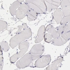 Immunohistochemical staining of human skeletal muscle shows no positivity in myocytes as expected.