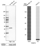 Western blot analysis in human cell lines SK-MEL-30 and Caco-2 using Anti-RAB27A antibody. Corresponding RAB27A RNA-seq data are presented for the same cell lines. Loading control: Anti-HSP90B1.