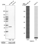 Western blot analysis in human cell lines SK-MEL-30 and Caco-2 using Anti-RAB27A antibody. Corresponding RAB27A RNA-seq data are presented for the same cell lines. Loading control: Anti-HSP90B1.