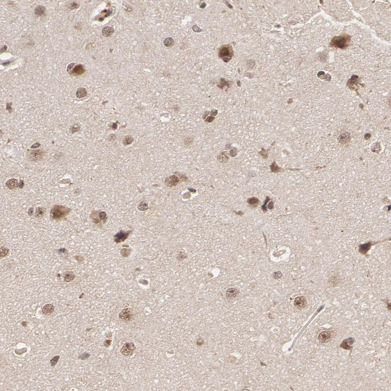 Anti-LIG4 Antibody