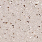 Anti-LIG4 Antibody