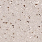 Anti-LIG4 Antibody