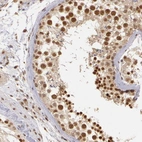Immunohistochemical staining of human testis shows moderate to strong nuclear positivity in cells in seminiferous ducts.
