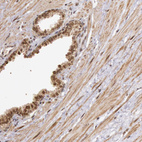 Immunohistochemical staining of human prostate shows strong nuclear positivity in glandular cells.