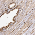 Immunohistochemical staining of human prostate shows strong nuclear positivity in glandular cells.