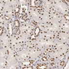 Immunohistochemical staining of human kidney shows moderate to strong nuclear positivity in cells in tubules.