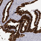 Anti-PTGS2 Antibody